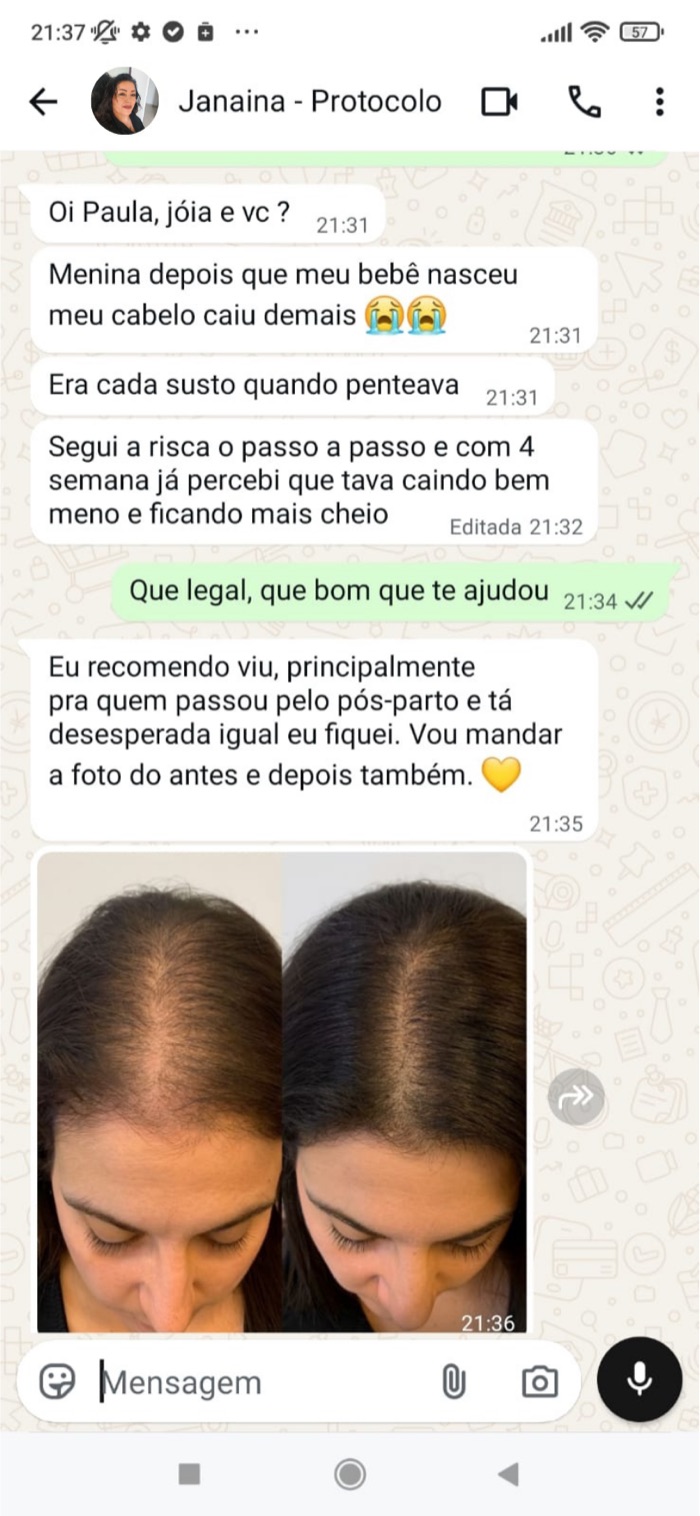 Depoimento e foto antes e depois de Janaina