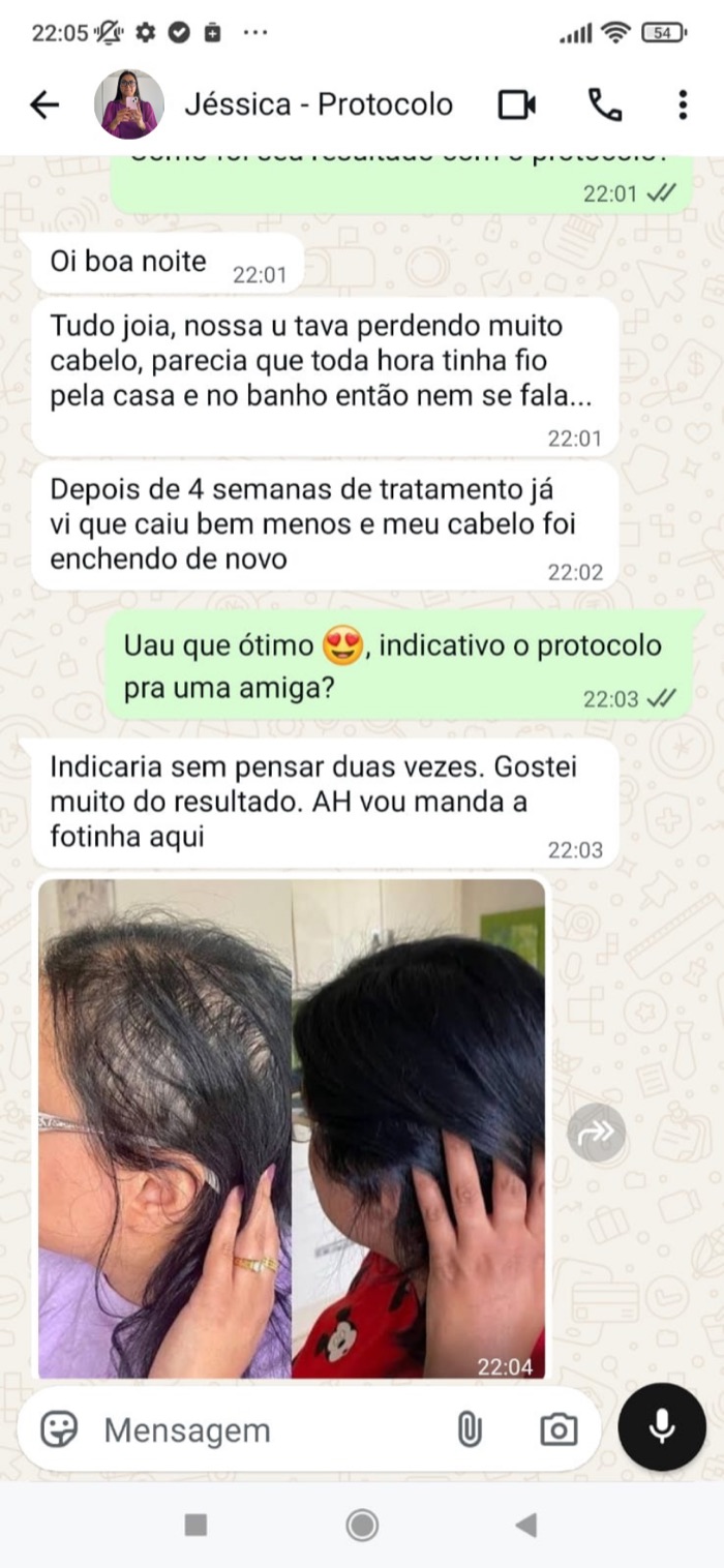 Depoimento e foto antes e depois de Jéssica