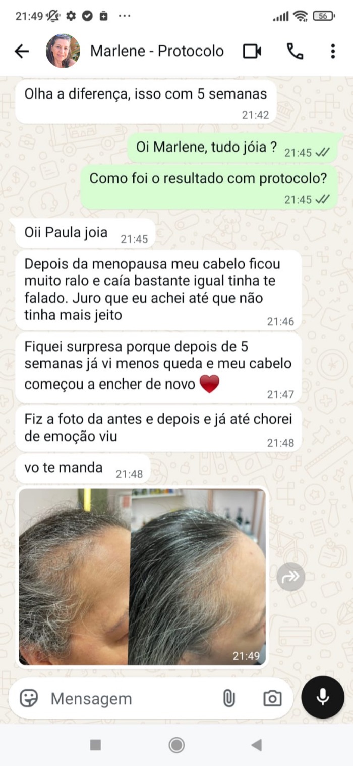 Depoimento e foto antes e depois de Marlene
